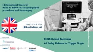 03 DR curso ecografia V01 A1 Pulley release for Trigger Finger