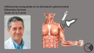 12 Infiltracion glenohumeral 1 curso ecografia V43 Infiltraciones ecoguiadas en la articulación glenohumeral. Diferentes técnicas
