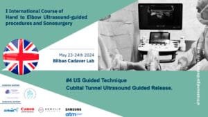 2023 07 liberacion ecoguiada canal cubital English D1 1 curso ecografia V02 Cubital Tunnel ultrasound guided release