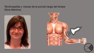 7 Tendinopatias y roturas de la porcion larga del biceps 1 curso ecografia V51 Tendinopatías y roturas de la porción larga del bíceps