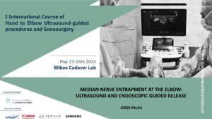 A5 median nerve entrapament at the elbow curso ecografia V05 Median nerve entrapament at the elbow