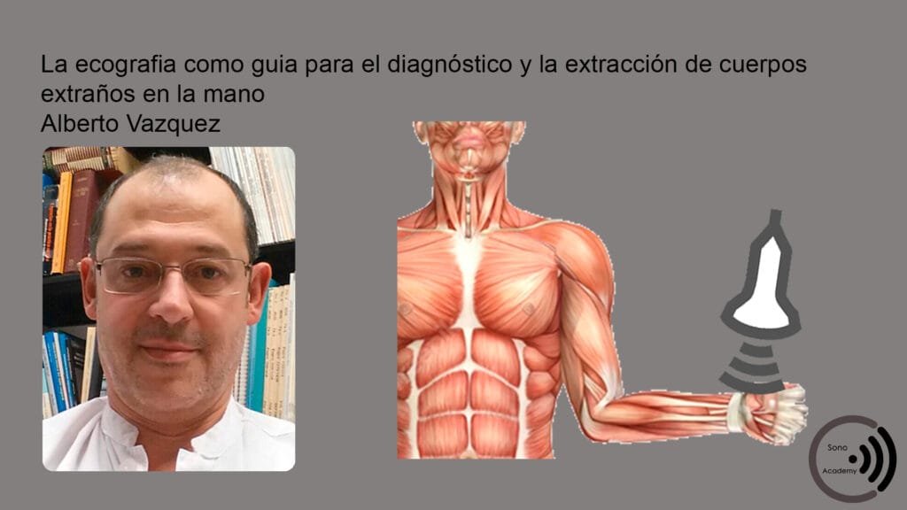 CMM 26 diagnostico y la extraccion de los cuerpos extranos mano 1 curso ecografia V40 La ecografía como guía para el diagnóstico y la extracción de los cuerpos extraños en la mano