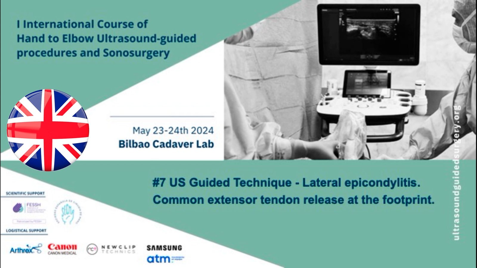 V04 Common extensor tendon release at the fotprint - sonoacademy.es