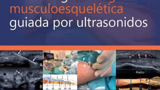 sonocirugia Portada del libro