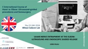 ULNAR NERVE ENDOSC 1 curso ecografia V08 ULNAR NERVE Entrapament at the elbow